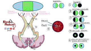 Visual Field Defects and Optic Nerve Pathway  Homonymous Hemianopia Bitemporal Hemianopia NEW 2020 [upl. by Aiyotal]