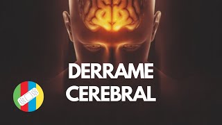 DERRAME CEREBRAL [upl. by Aicul]