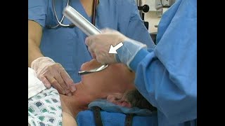 Orotracheal Intubation [upl. by Theobald284]